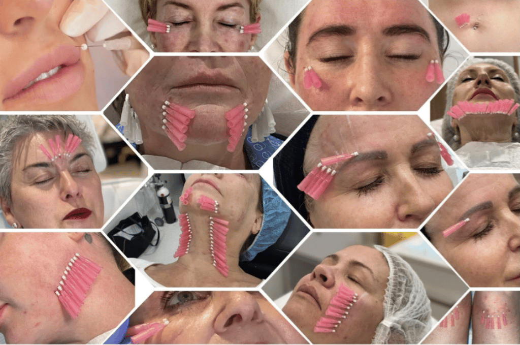 4 Non-Invasive Methods for Tightening Sagging Skin