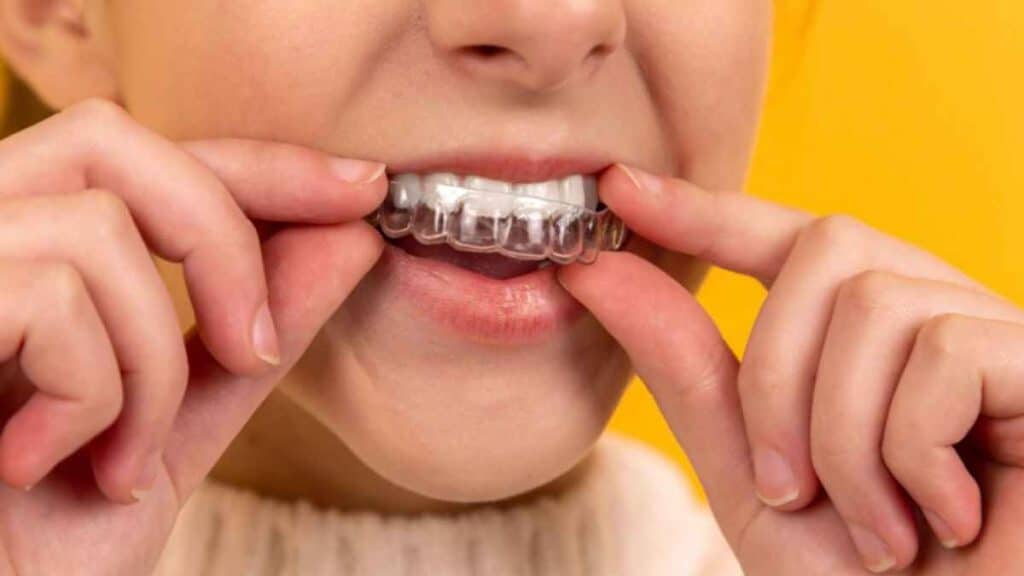 Hastings Dentists Your One-Stop Guide to Choosing the Best Dental Care Provider in Hastings