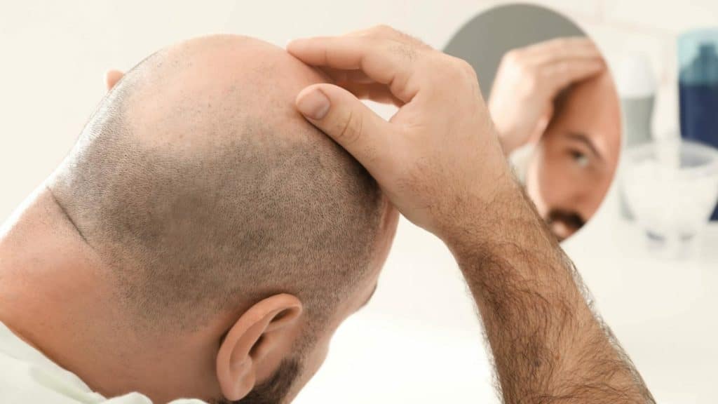 Why Non-Surgical Hair Restoration Might Be Right for You