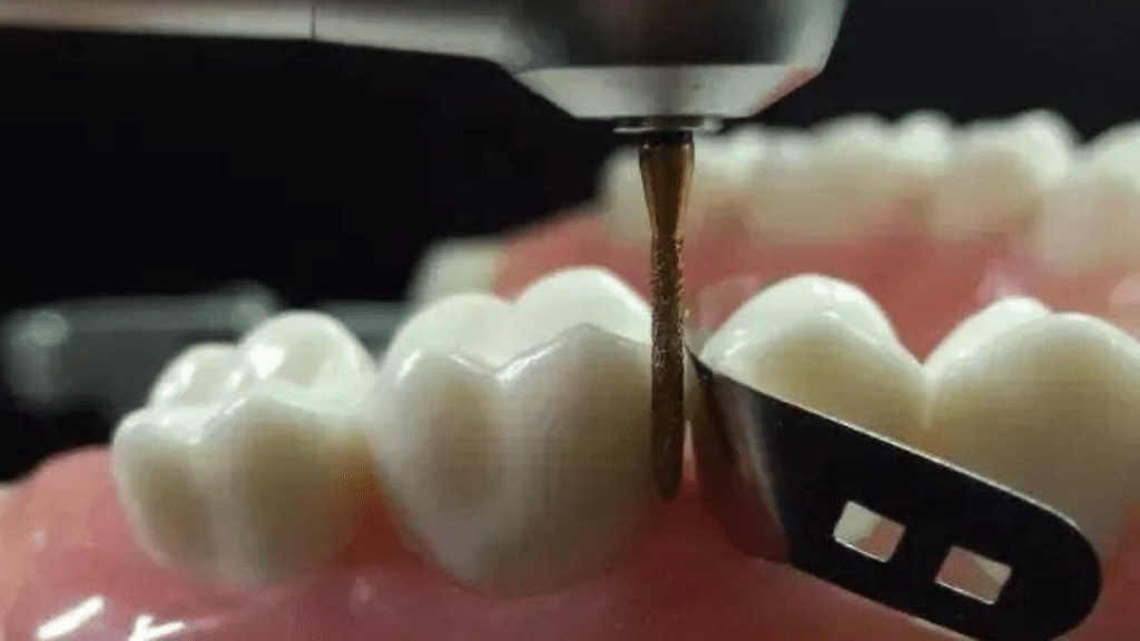 How to Choose the Best Endodontic Burs for Root Canal Treatment?