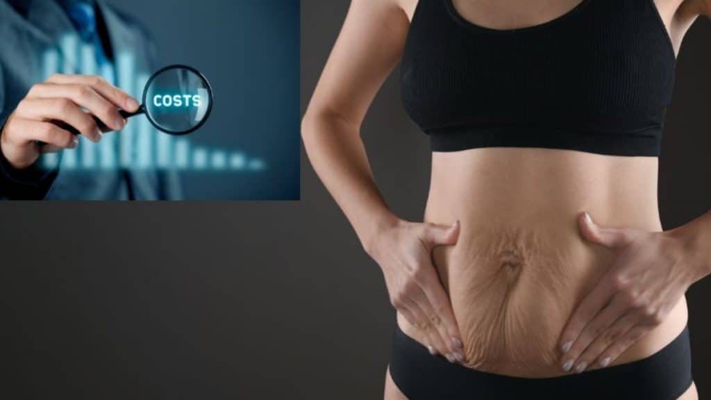 How to Prepare for Abdominoplasty Surgery in Australia