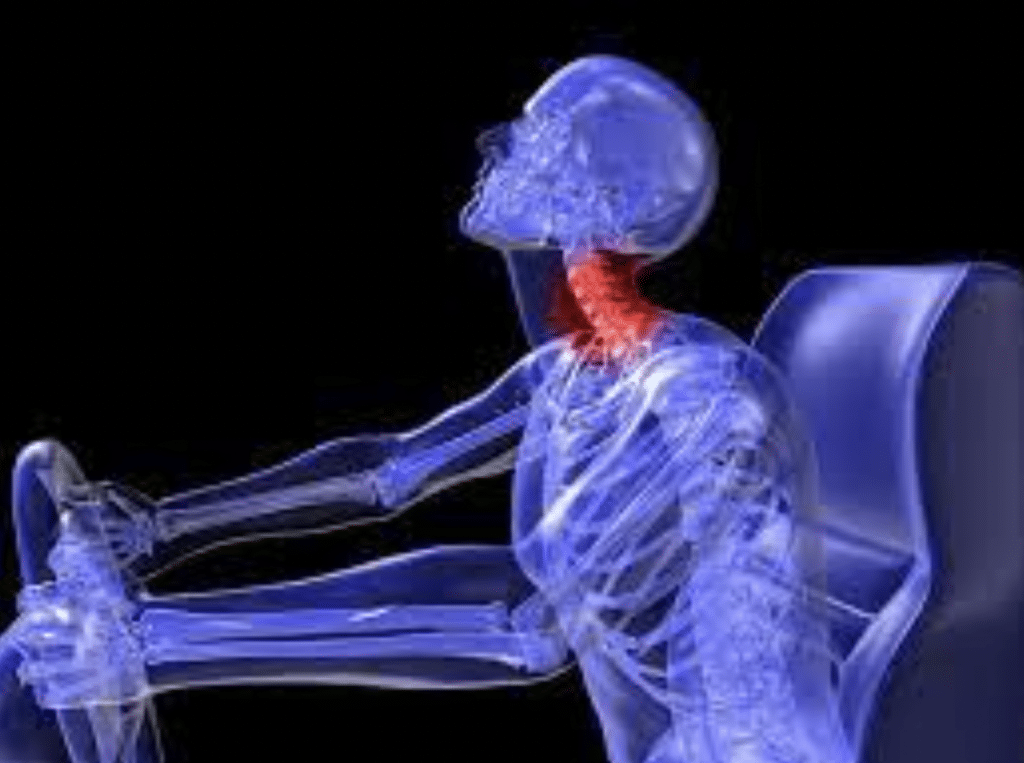 Pain That Doesn’t Show on X-Rays: Proving Soft-Tissue and Nerve Damage