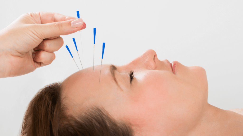 7 Surprising Conditions Acupuncture Can Help Treat