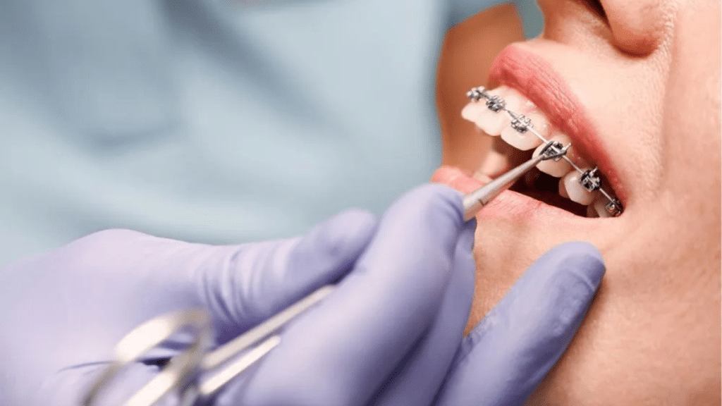 How Orthodontics Can Improve Your Bite and Confidence