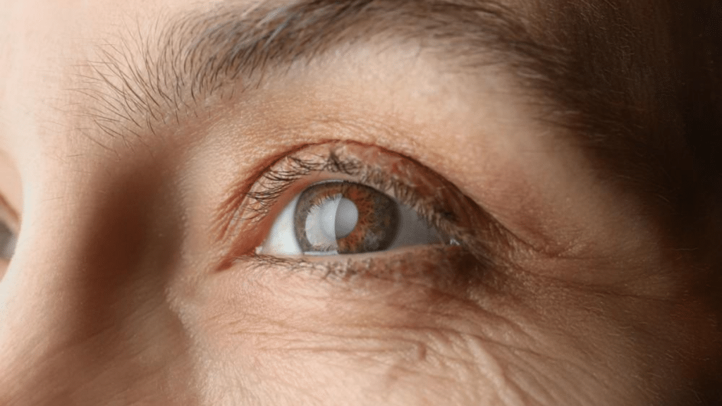 What to Expect Before, During, and After Cataract Surgery — No Surprises, Just Clarity