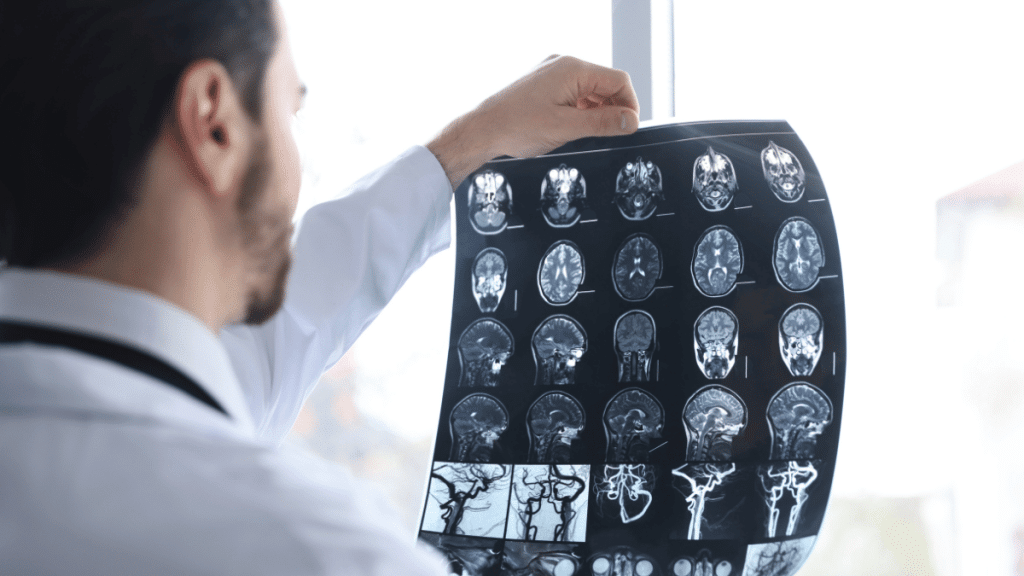 Traumatic Brain Injury: A Comprehensive Guide for Patients and Families Image 1 of Traumatic Brain Injury: A Comprehensive Guide for Patients and Families